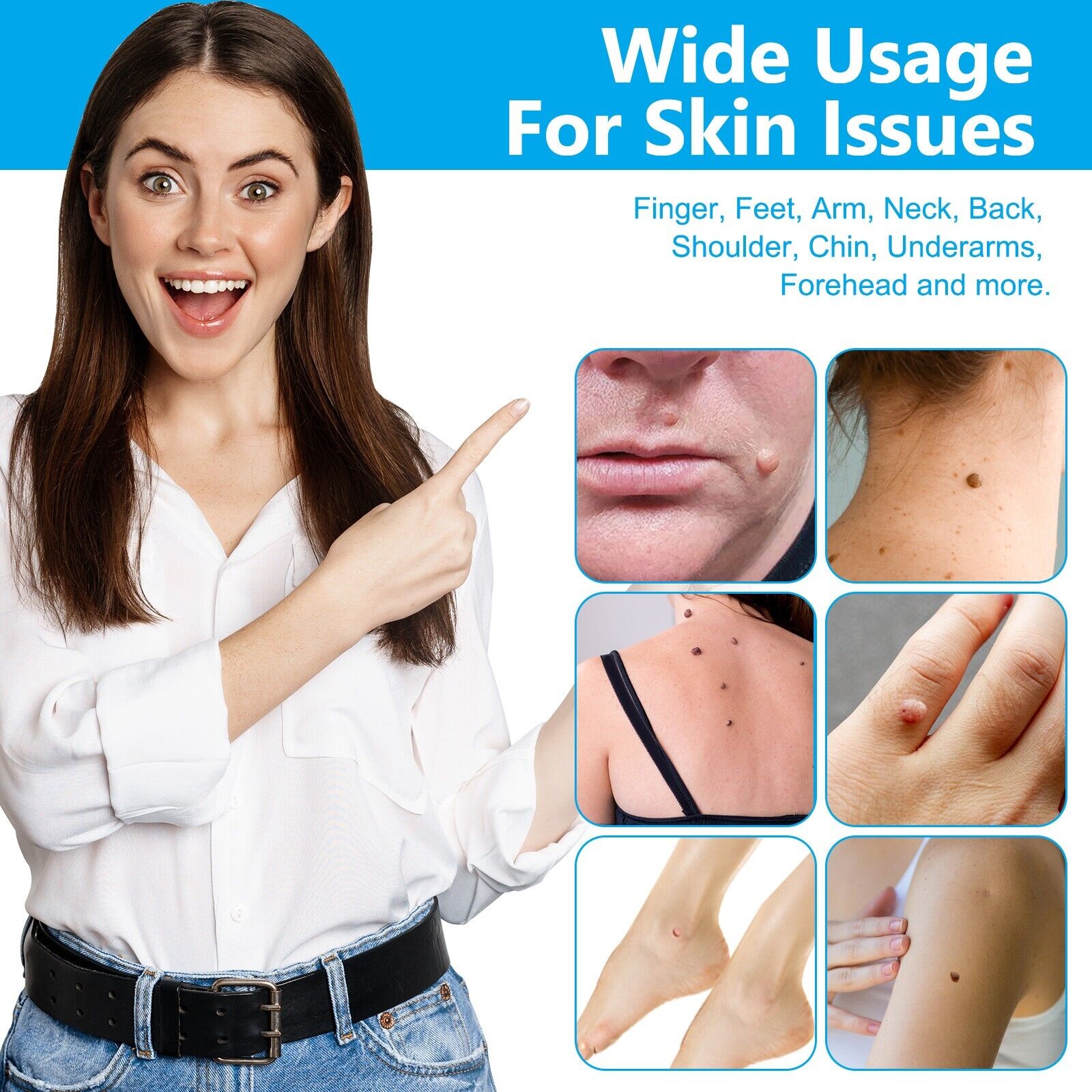 #1 NEW SKIN TAG REMOVAL KIT PAINLESS REMOVER FAST EASY SAFE MOLE WART SPOT TAGS